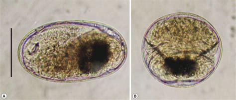 Metagonimus! This Tiny Trematode Will Make You Question Everything You Know About Fish Sushi