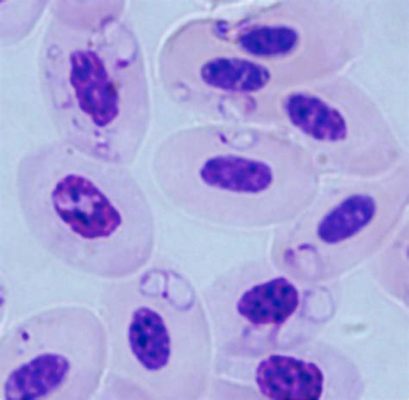  Babesia! A Tiny Parasite With a Giant Impact on Animal Health