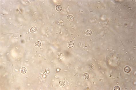  Cryptosporidium! A Microscopic Menace Lurking in Your Water