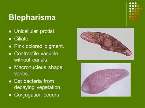  Did You Know That The Blepharisma Is A Ciliate Protist Known For Its Exquisite Sensitivity To Touch And Light?