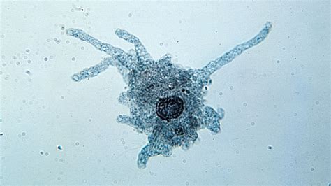 Molding Itself to Survive: This Shape-Shifting Amoeba Thrives by Extending Pseudopods for Movement and Food Capture!